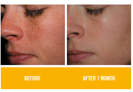 before & after