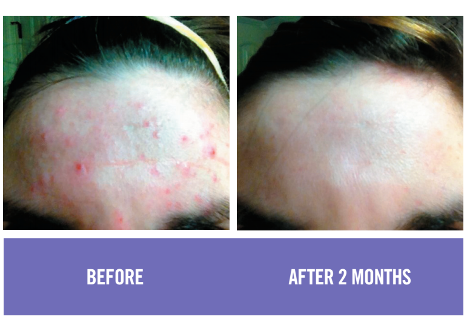 before & after